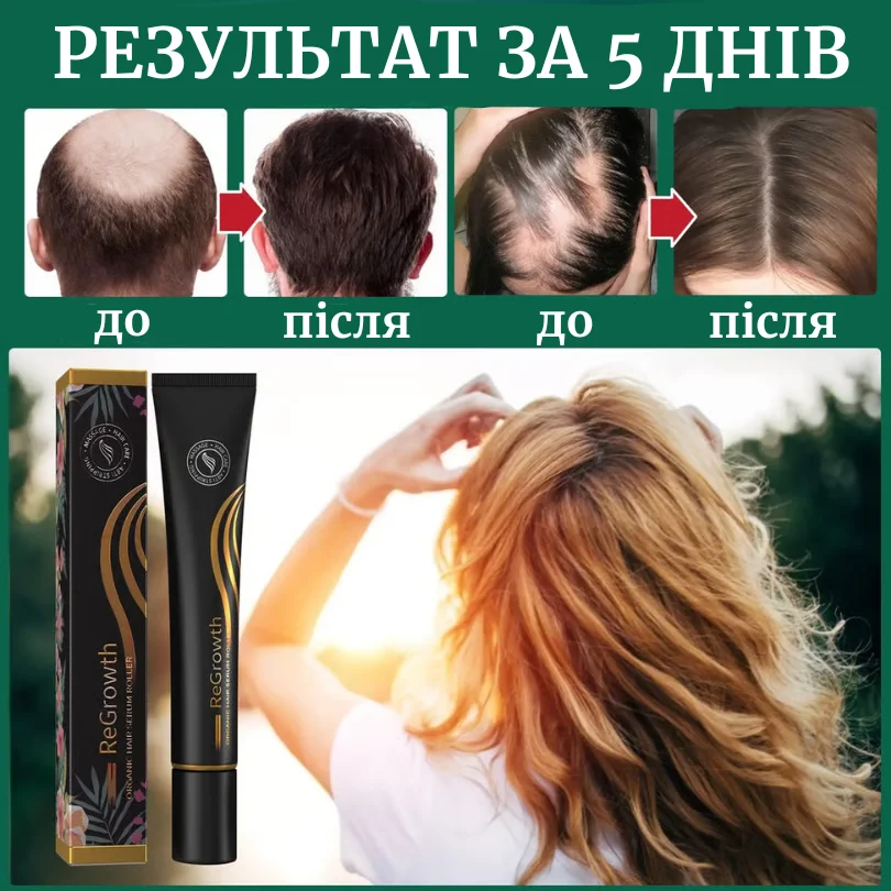 Лосьйон для росту волосся з женьшенем